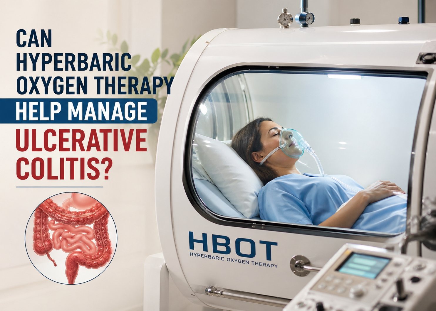 Hyperbaric Oxygen Therapy for Ulcerative Colitis